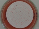 Foto 5: Membrane-filter Enterococcus selective agar acc. to SLANETZ and BARTLEY