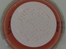 Slika 5: Membrane-filter Enterococcus selective agar acc. to SLANETZ 